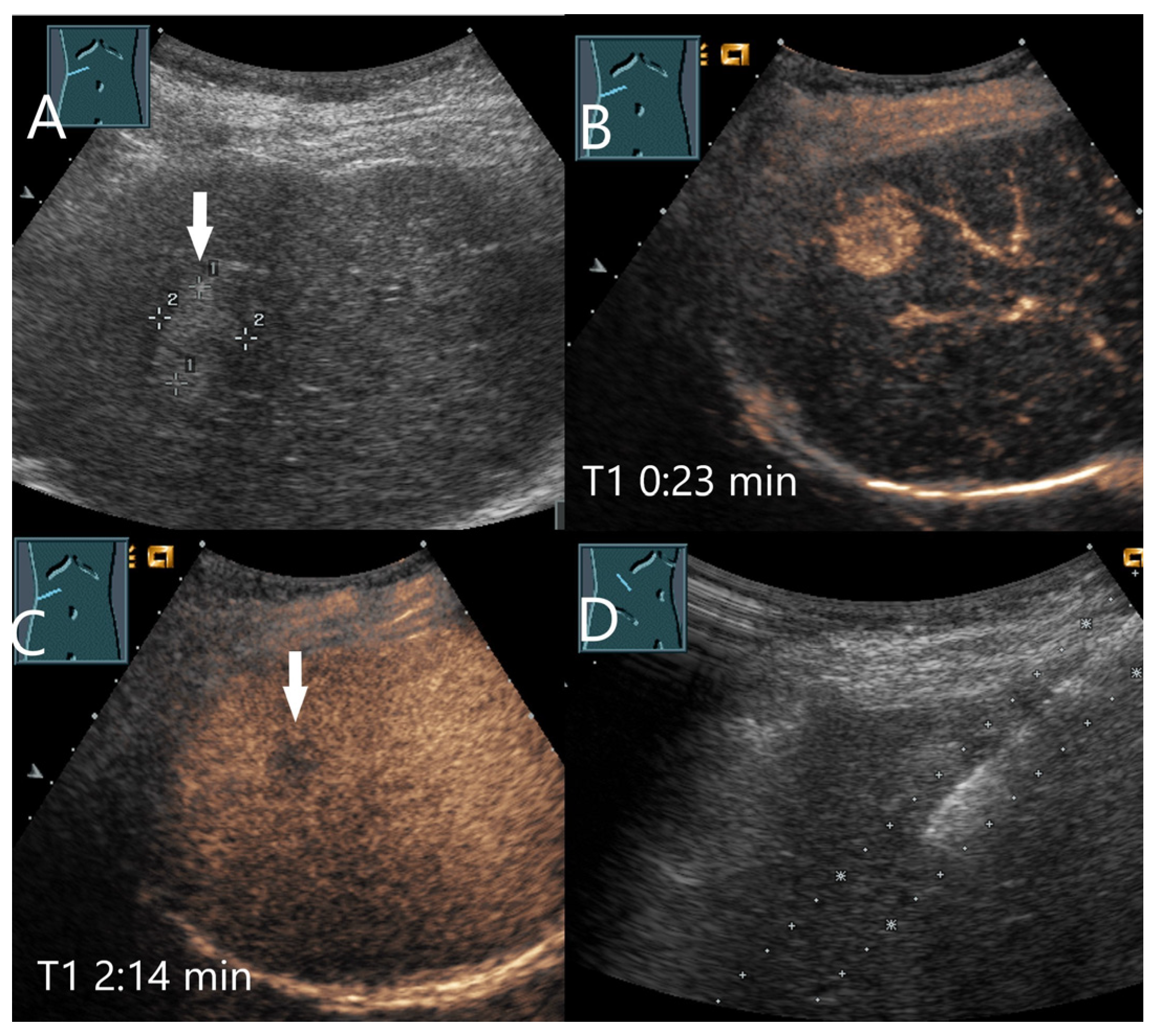 Diagnostics 15 00998 g007