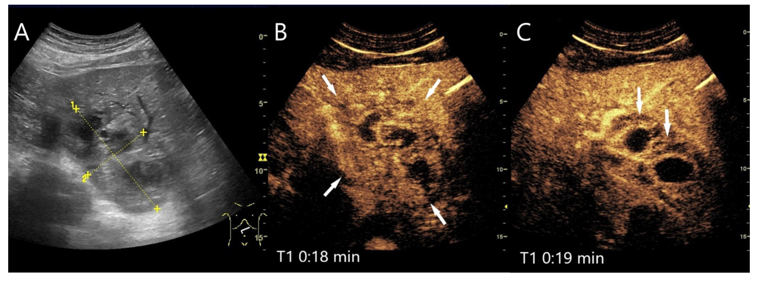Diagnostics 15 00998 g008