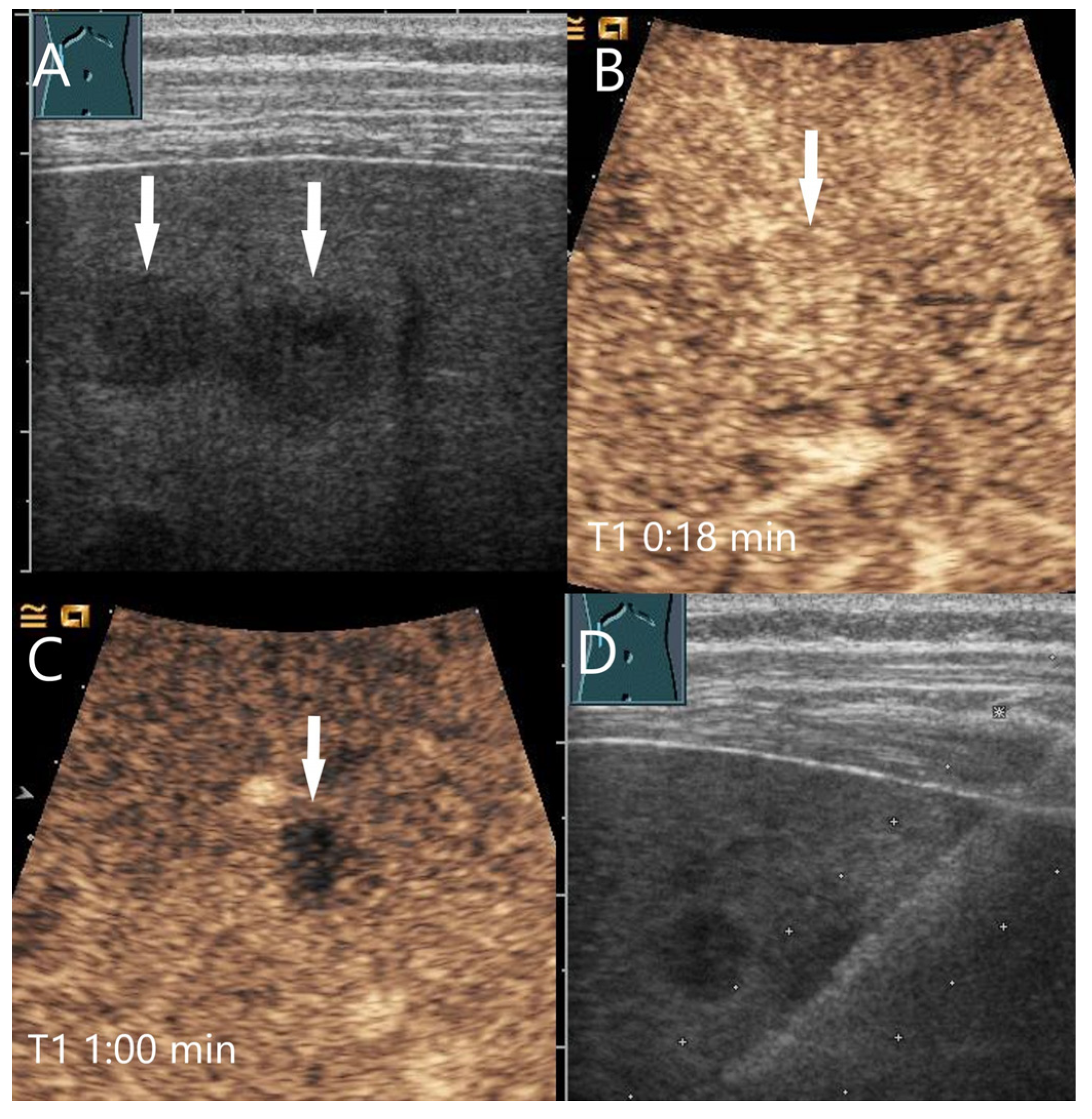 Diagnostics 15 00998 g010