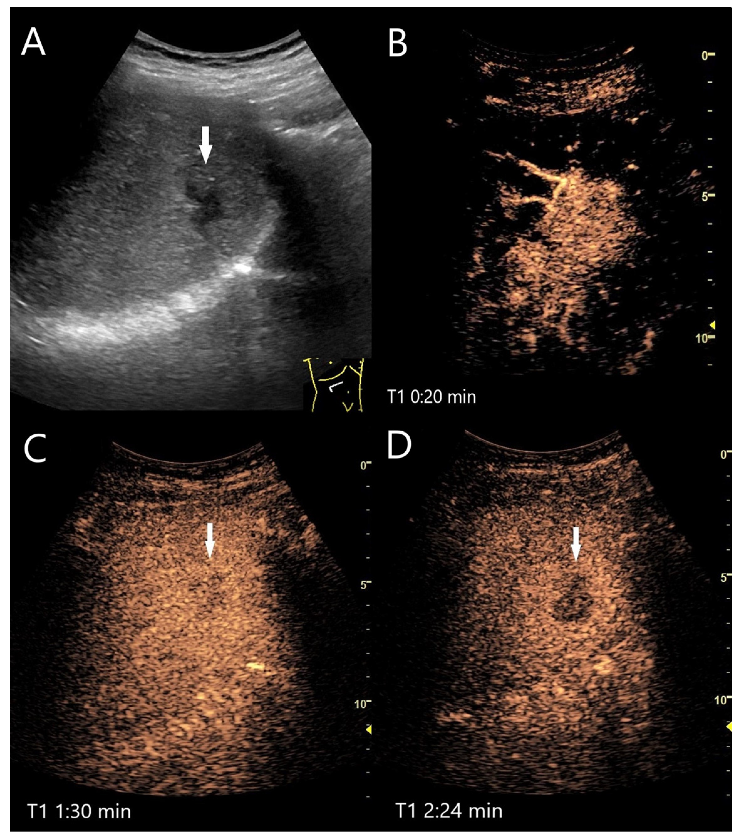 Diagnostics 15 00998 g011