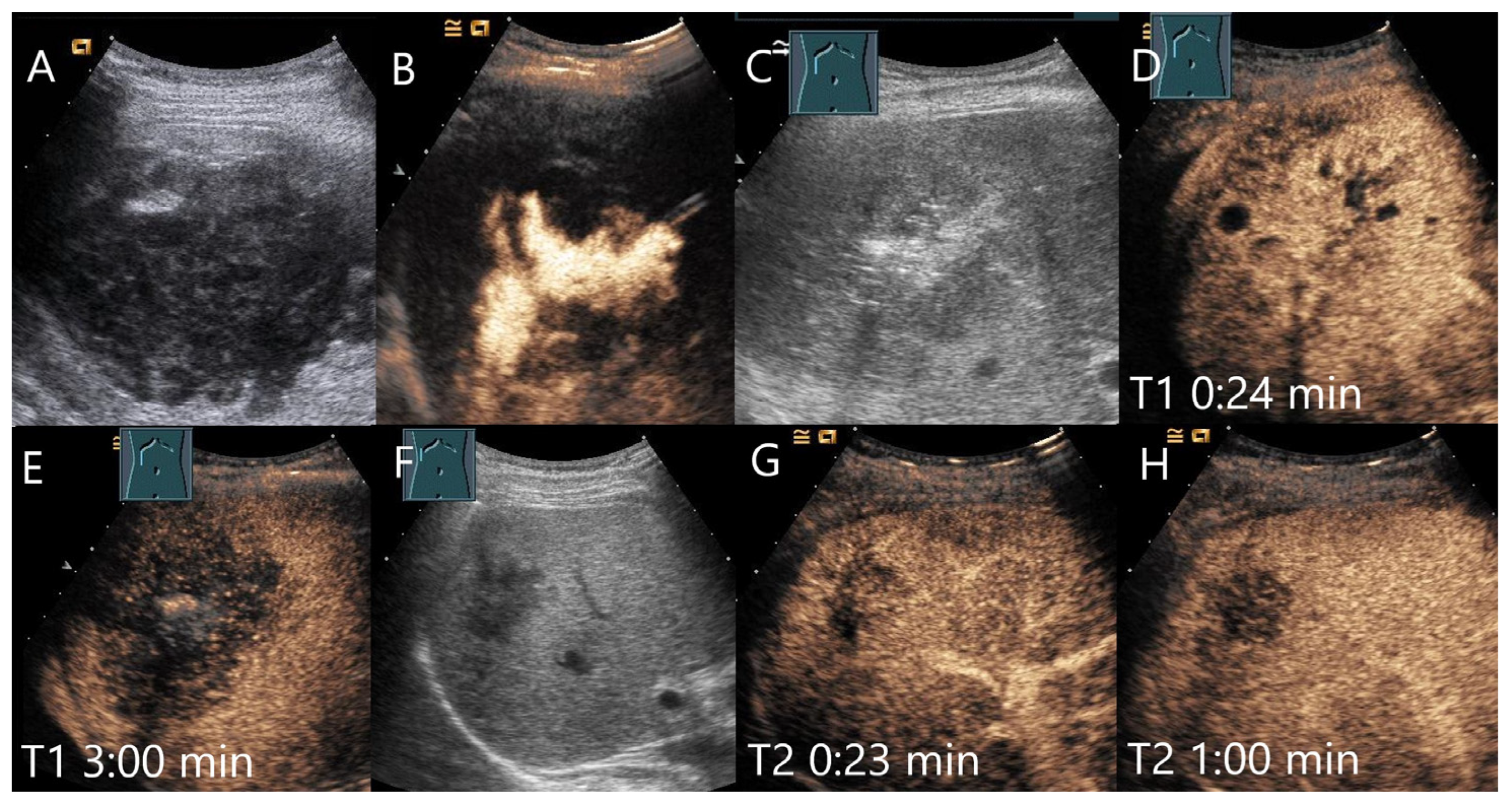 Diagnostics 15 00998 g012