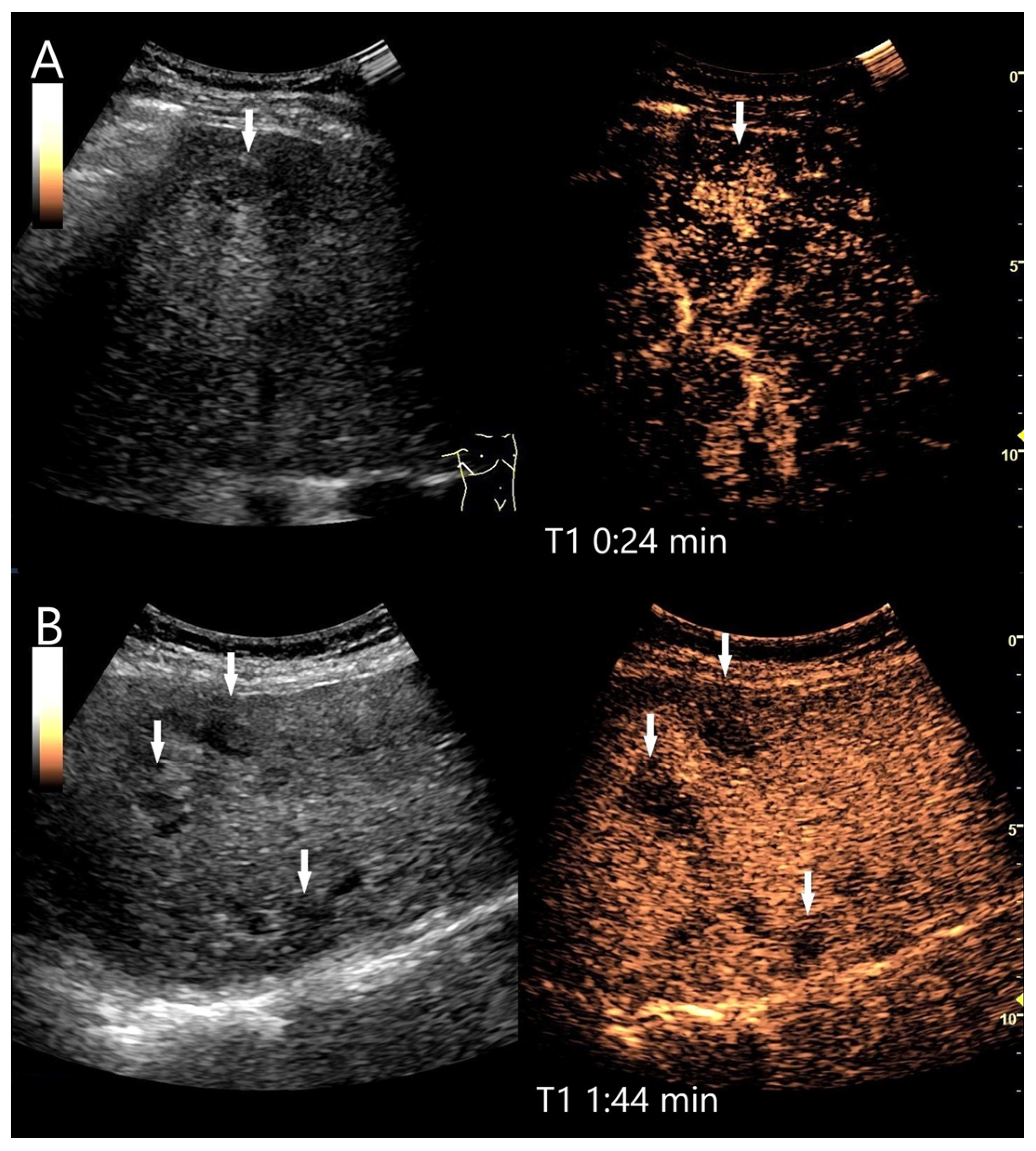 Diagnostics 15 00998 g013