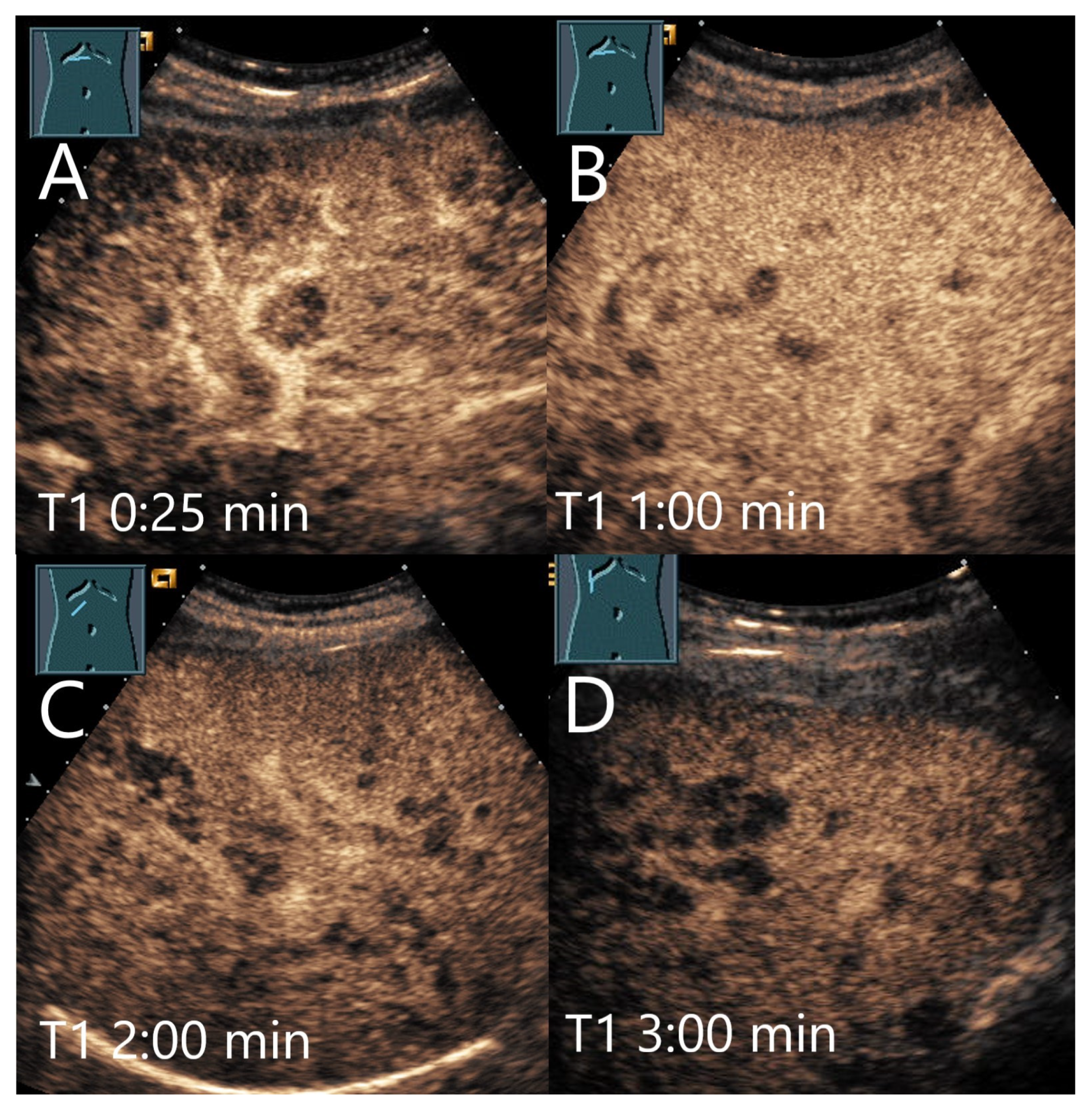 Diagnostics 15 00998 g014