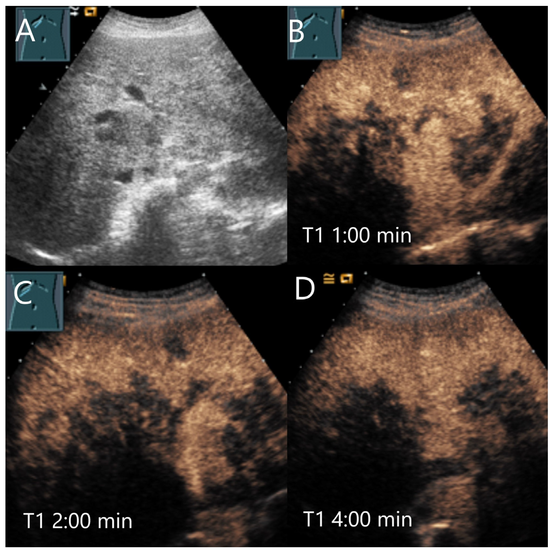 Diagnostics 15 00998 g015