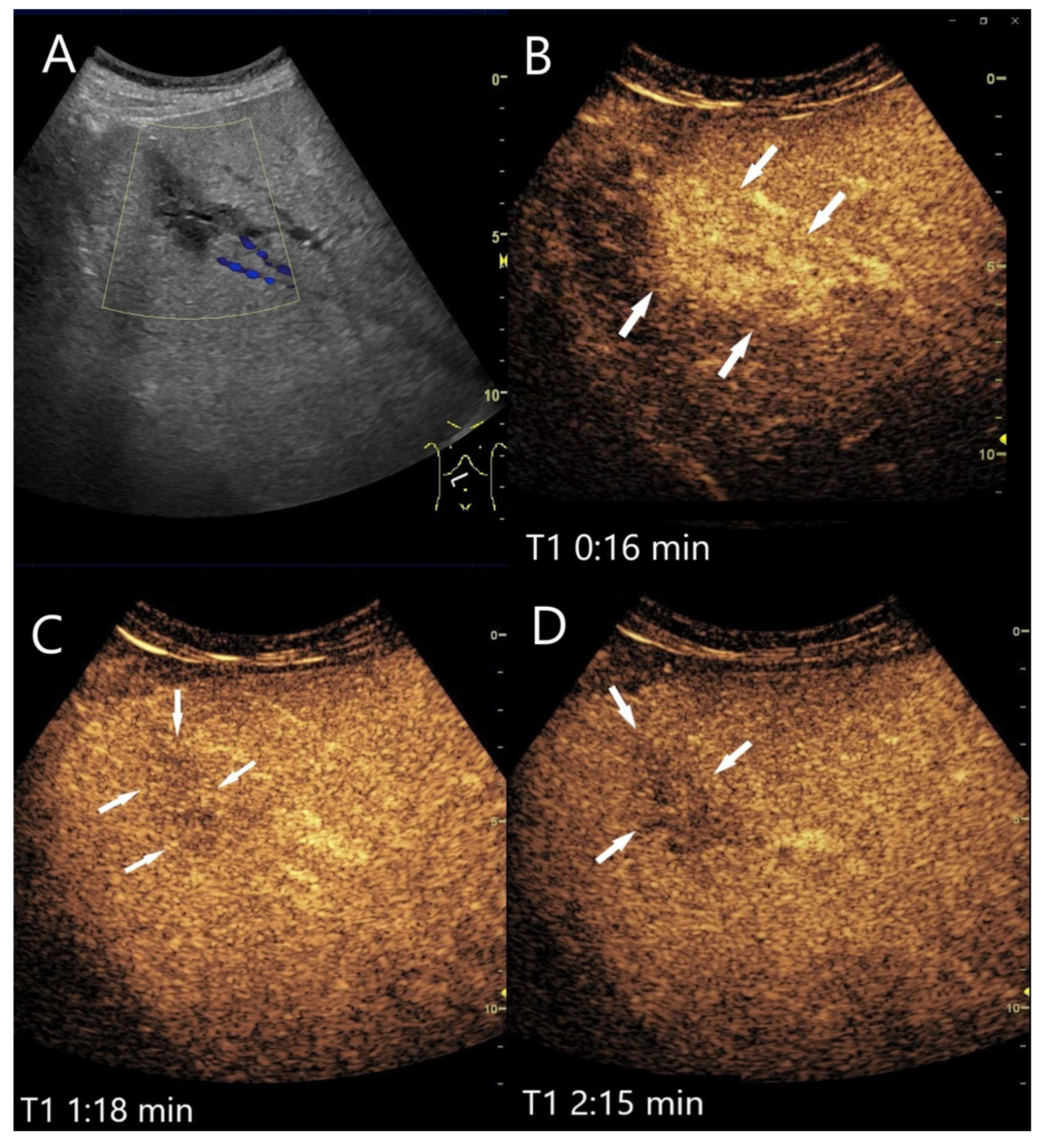 Diagnostics 15 00998 g016