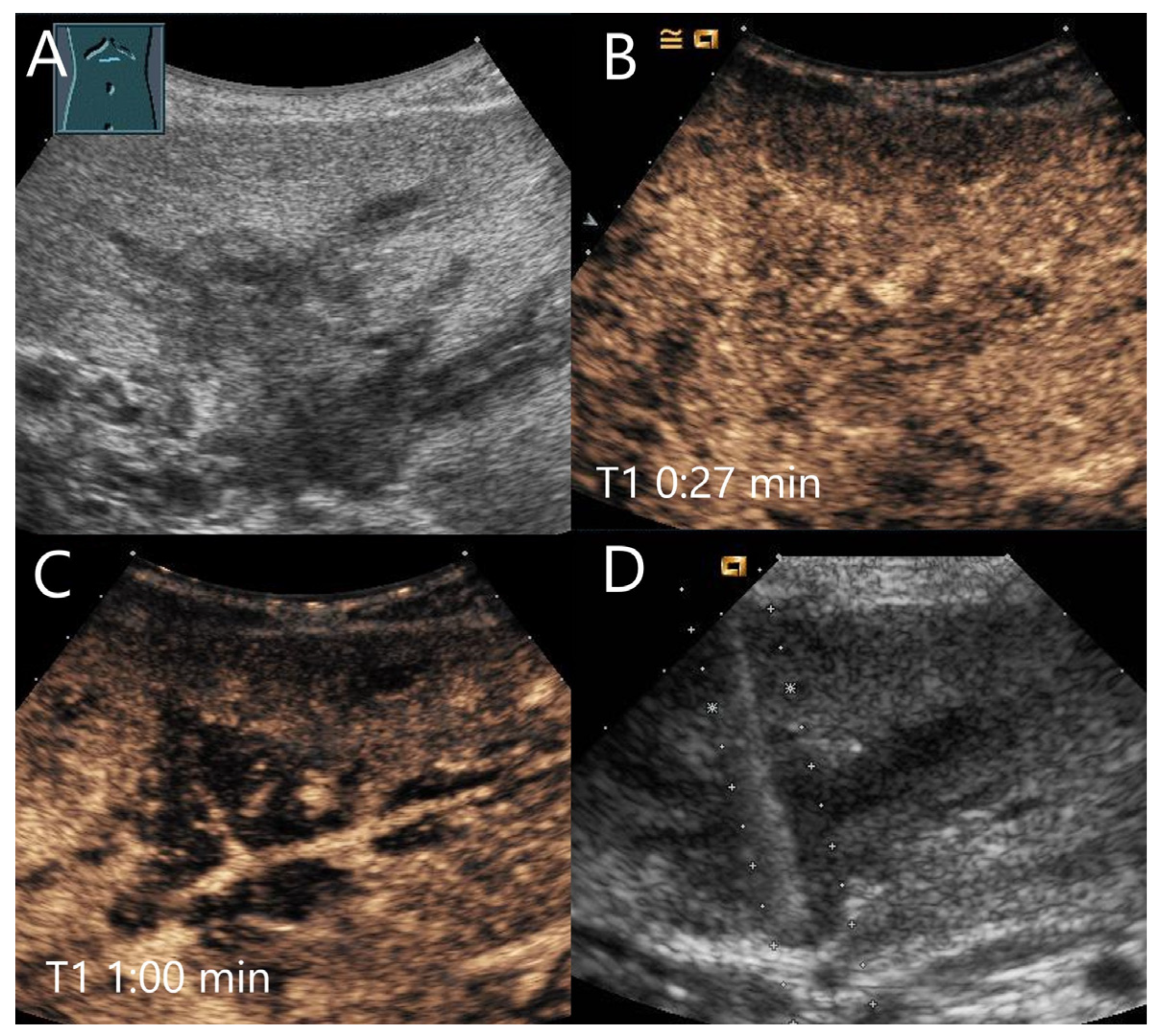 Diagnostics 15 00998 g017