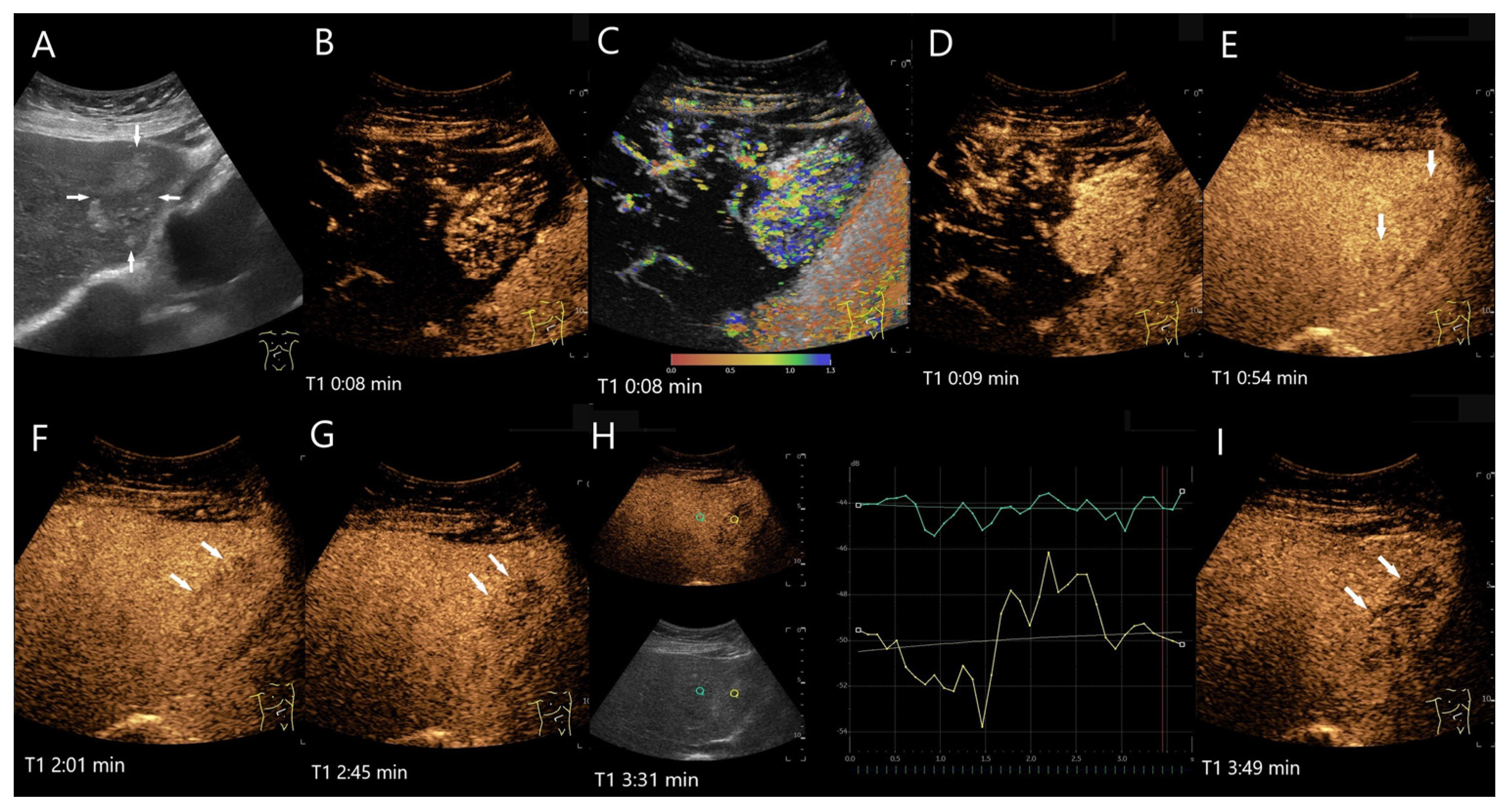Diagnostics 15 00998 g018