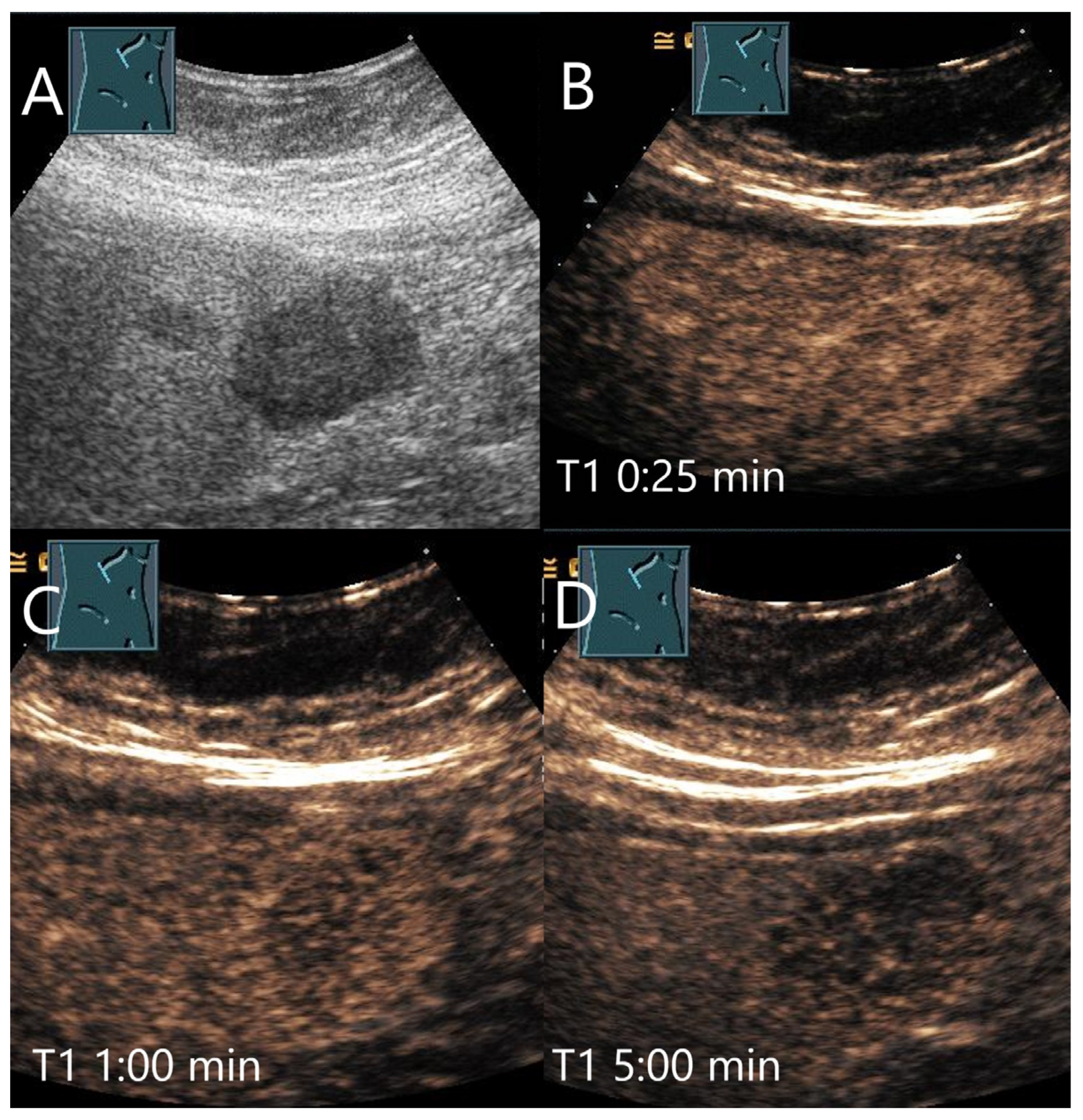 Diagnostics 15 00998 g019