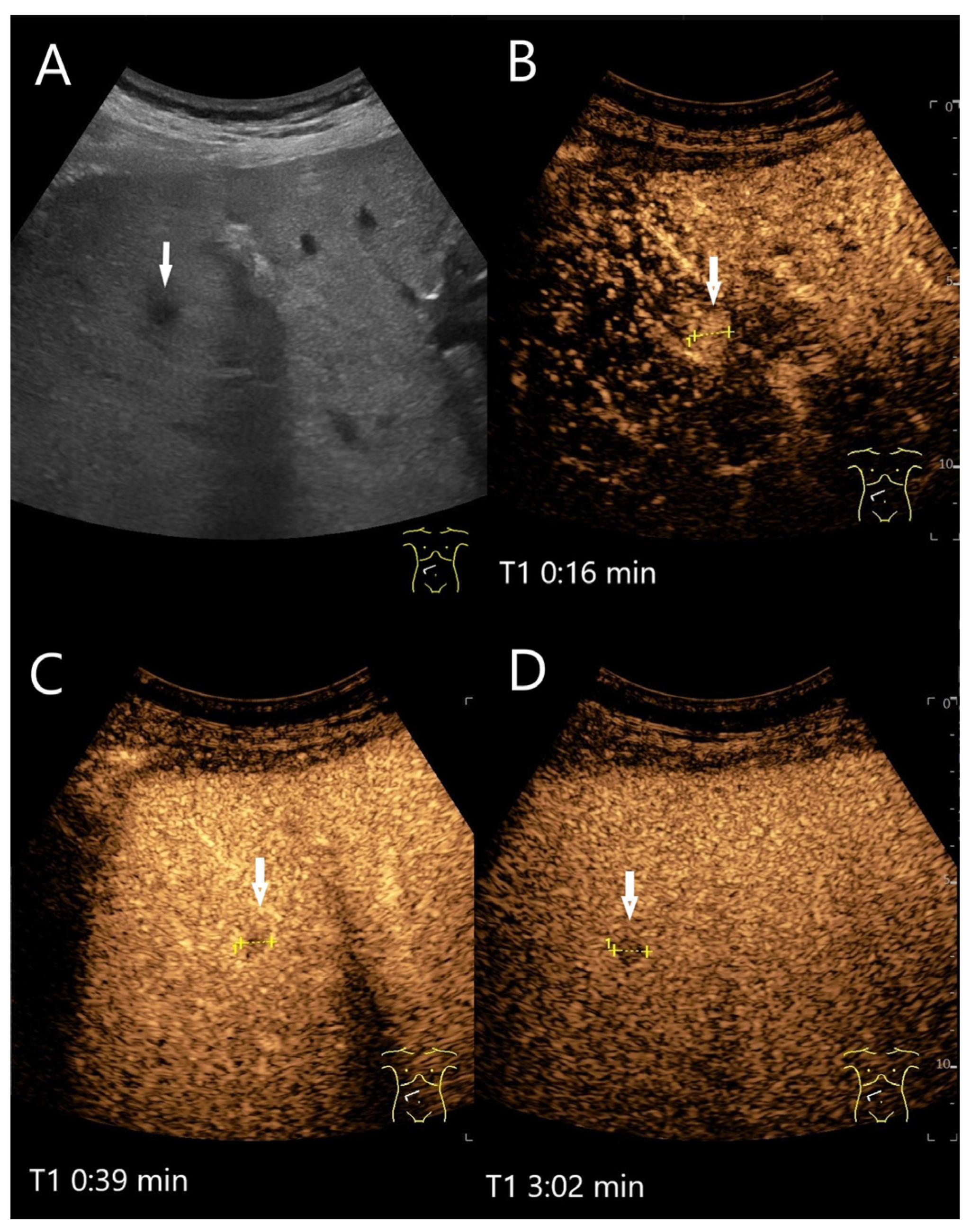 Diagnostics 15 00998 g020
