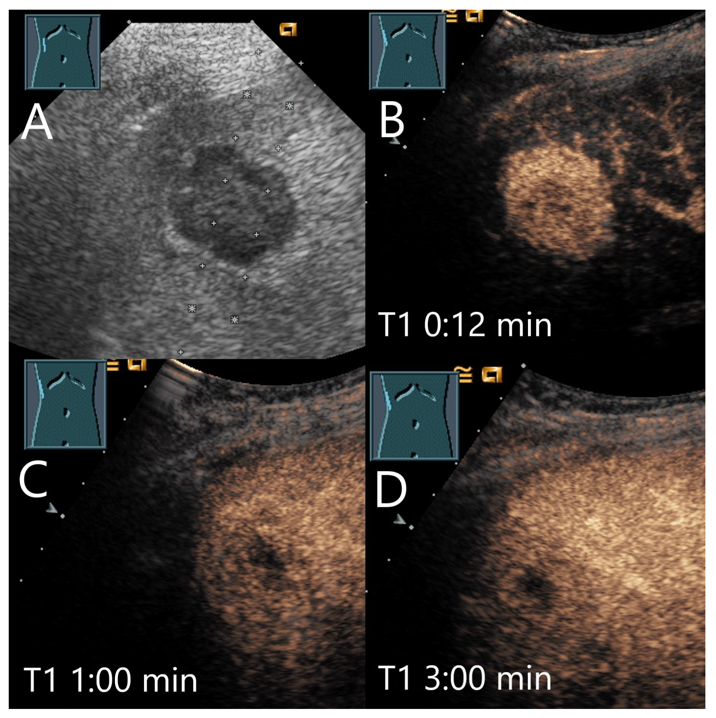 Diagnostics 15 00998 g021