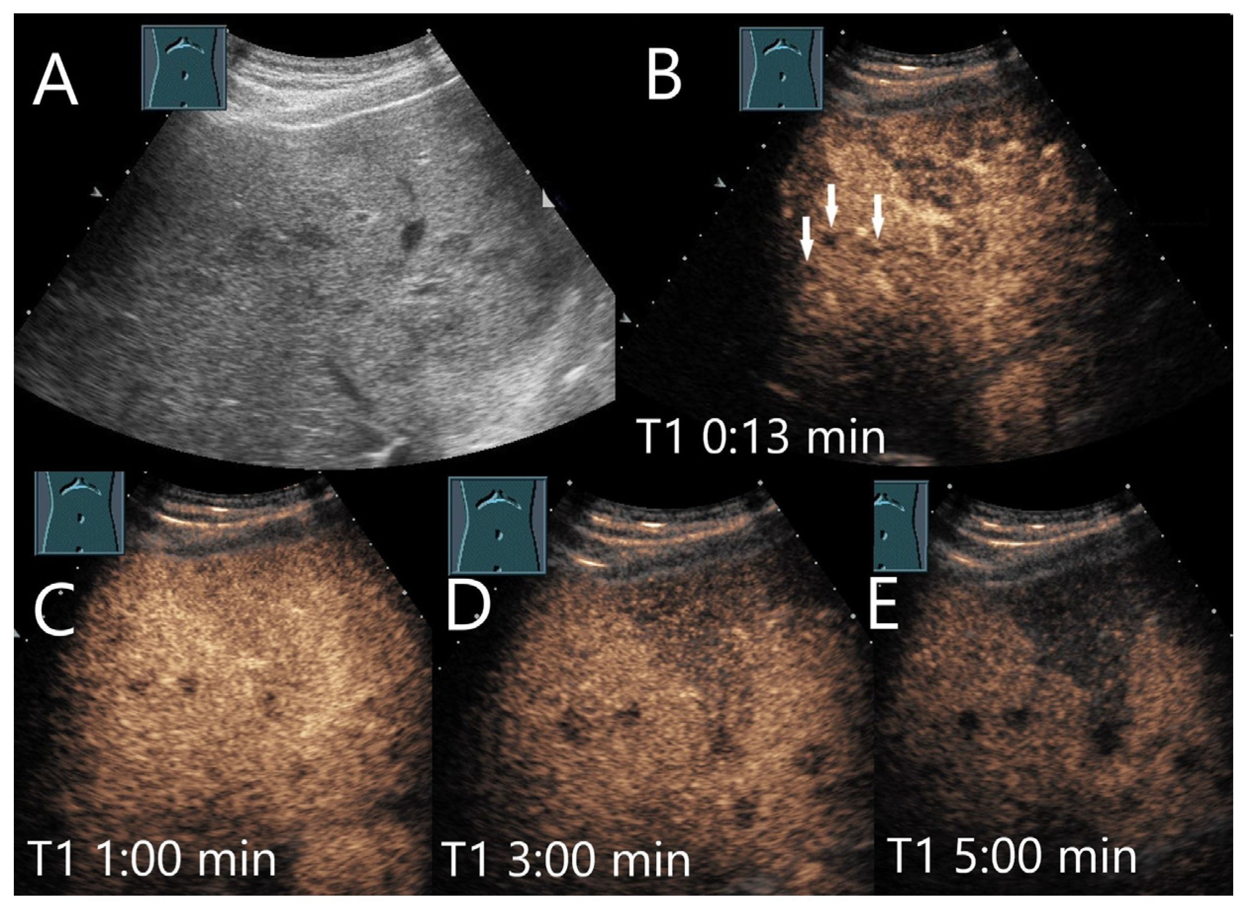 Diagnostics 15 00998 g022