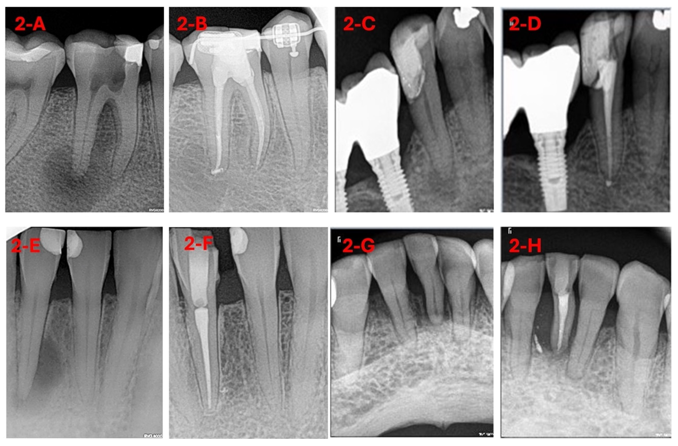 Diagnostics 15 01009 g002 Diagnostics 15 01009 g002