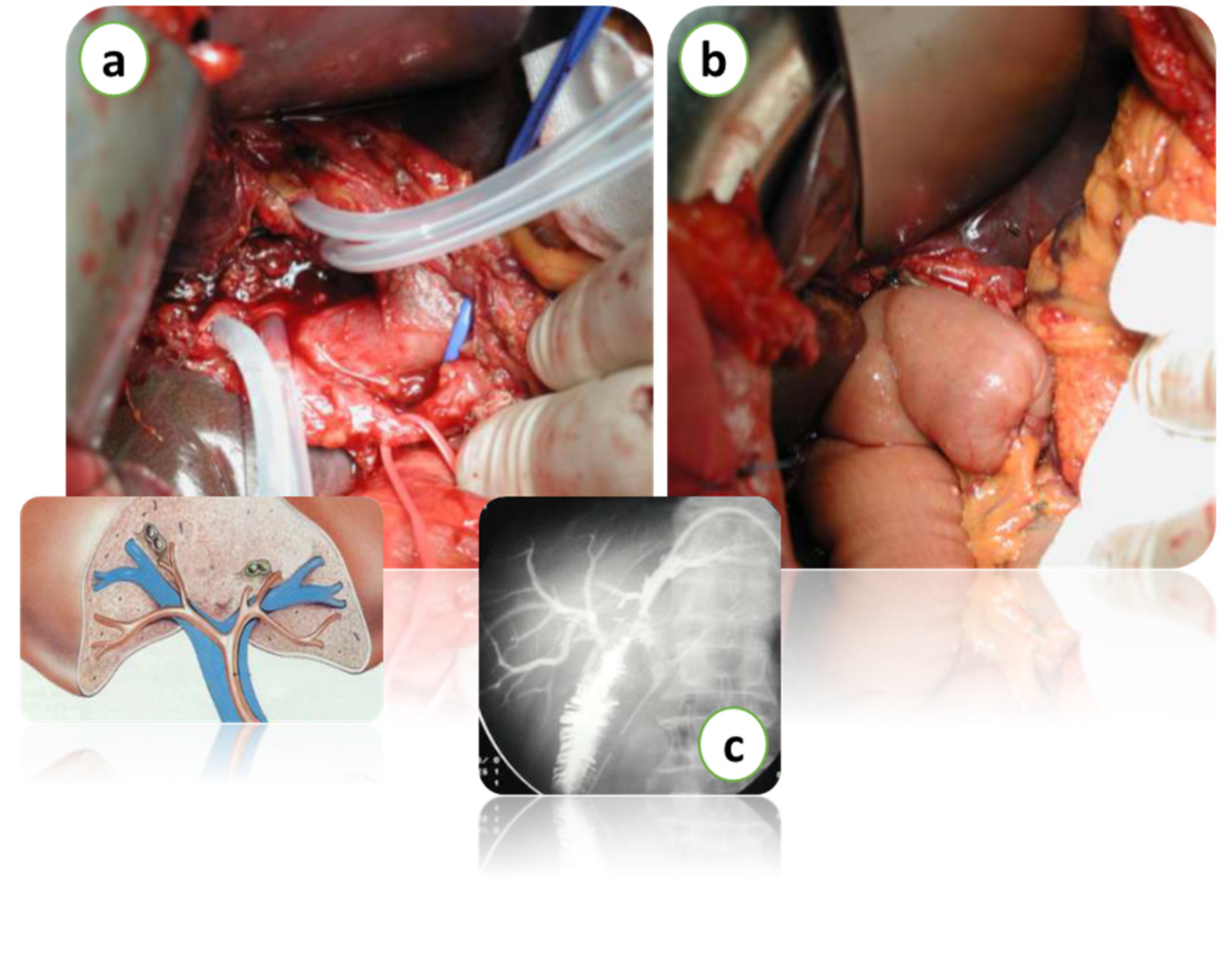 Diagnostics 15 01011 g004