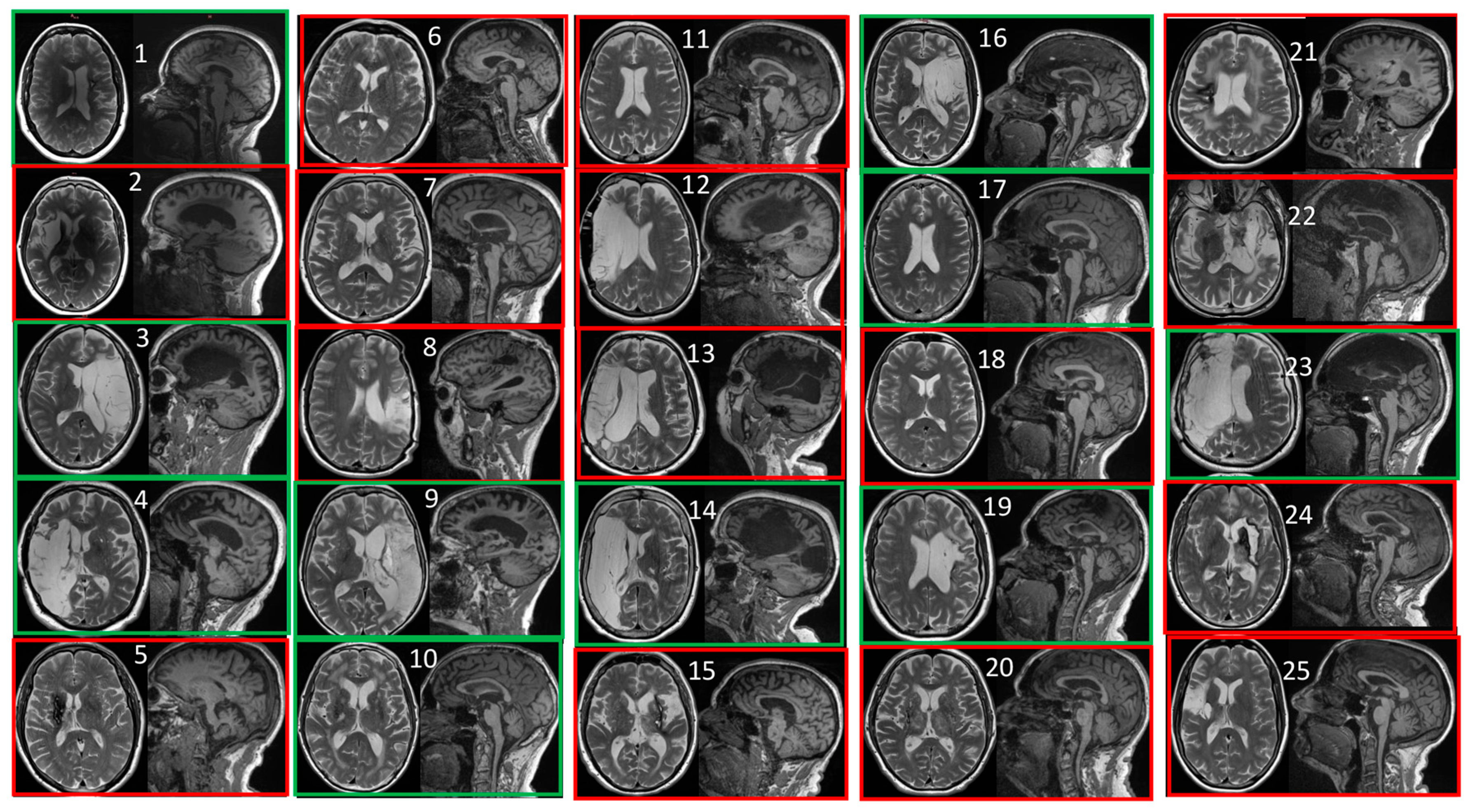 Diagnostics 15 01020 g002