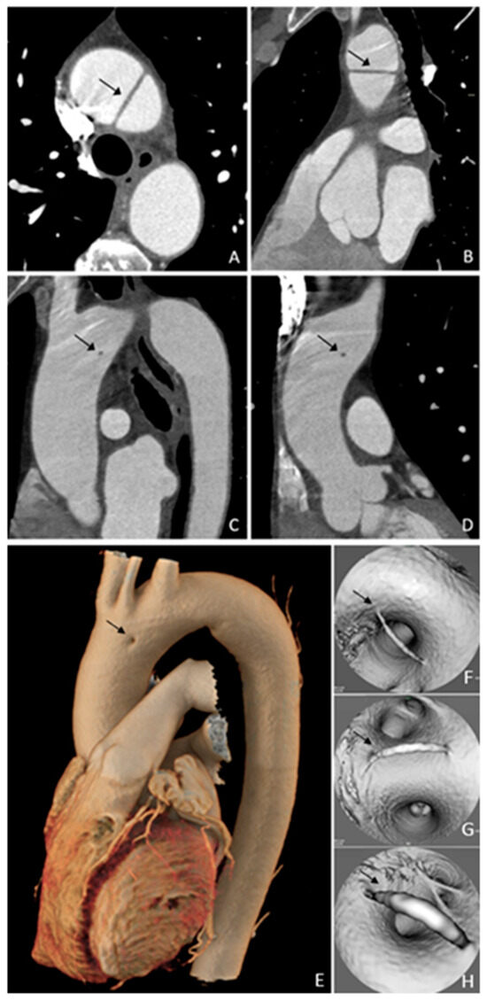 Diagnostics 15 01036 g001