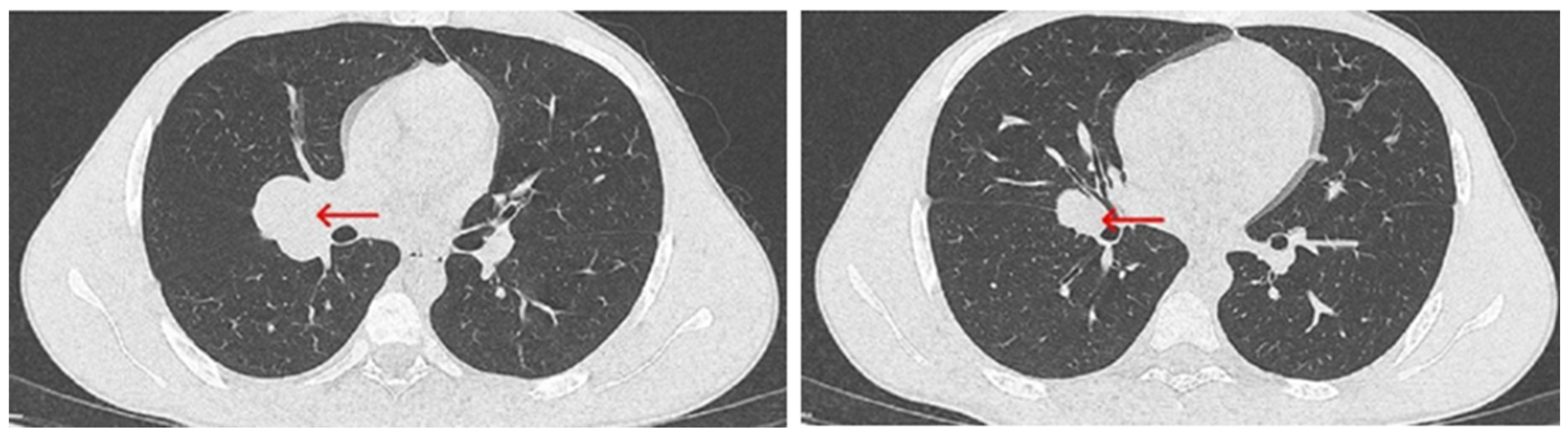 Diagnostics 15 01056 g004