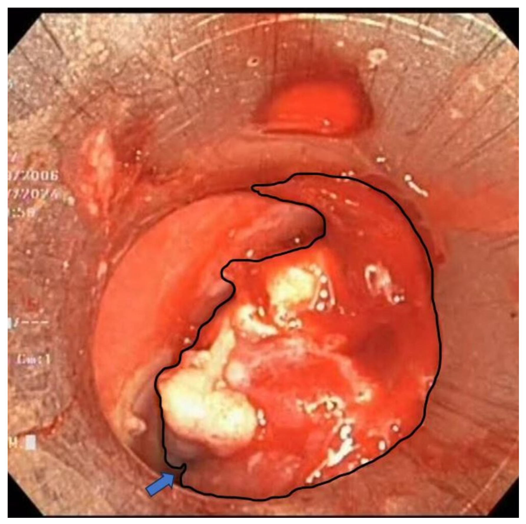 Diagnostics 15 01056 g005