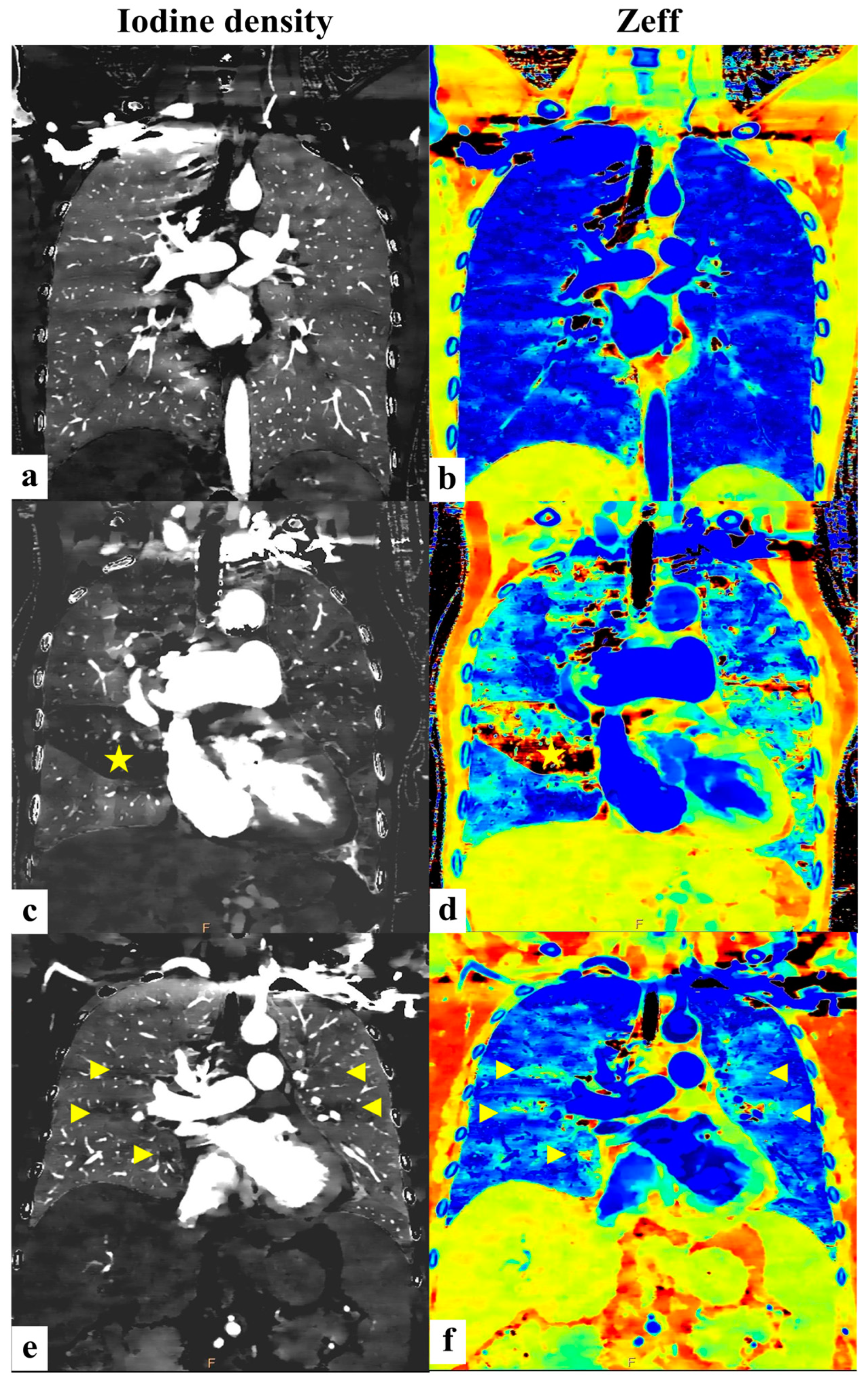 Diagnostics 15 01069 g005