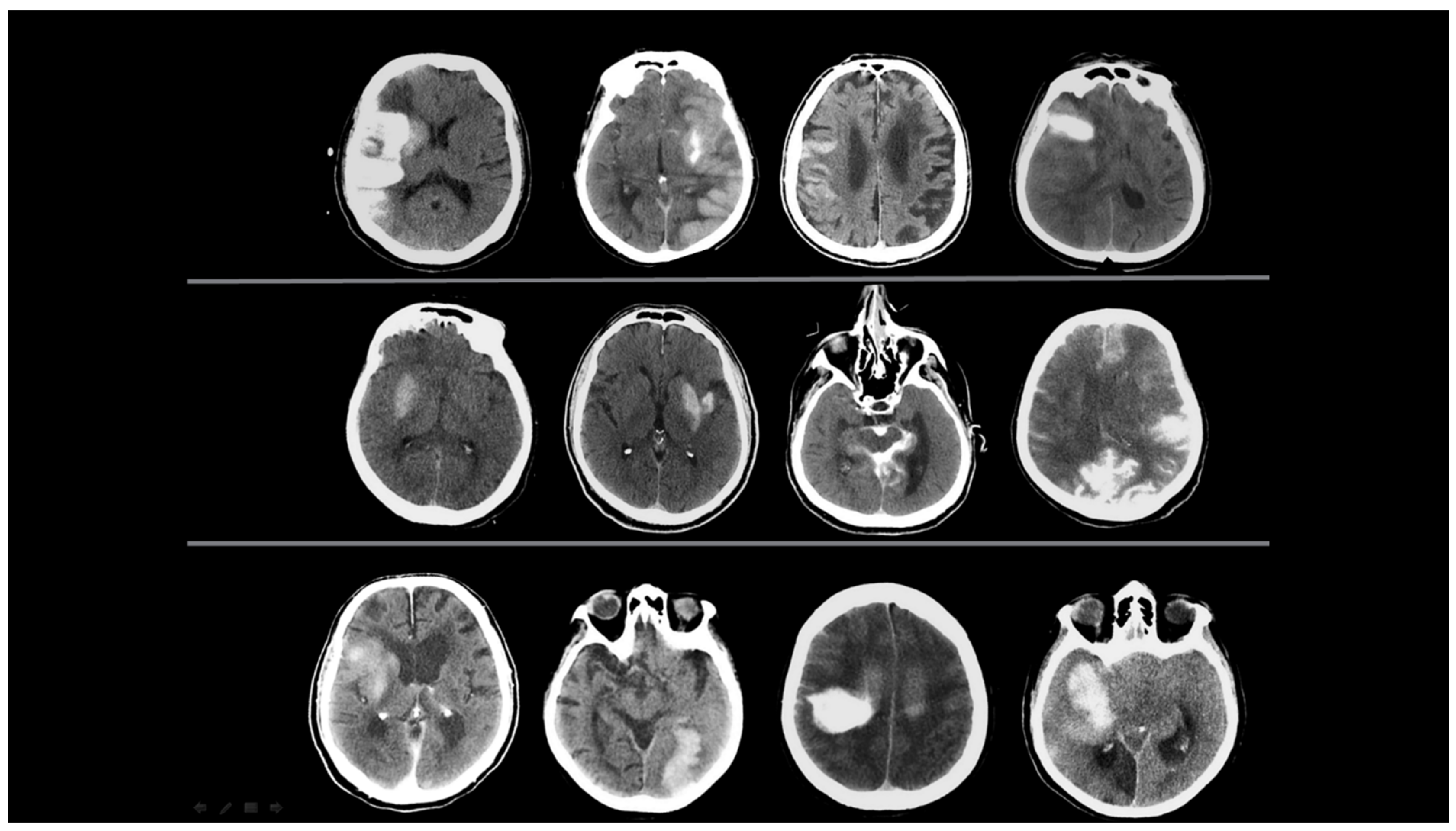 Diagnostics 15 01080 g001