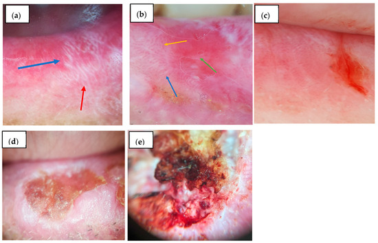 Diagnostics 15 01084 g001