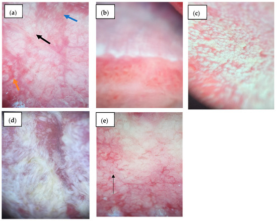 Diagnostics 15 01084 g002