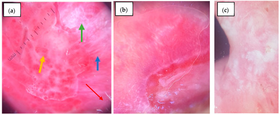 Diagnostics 15 01084 g003