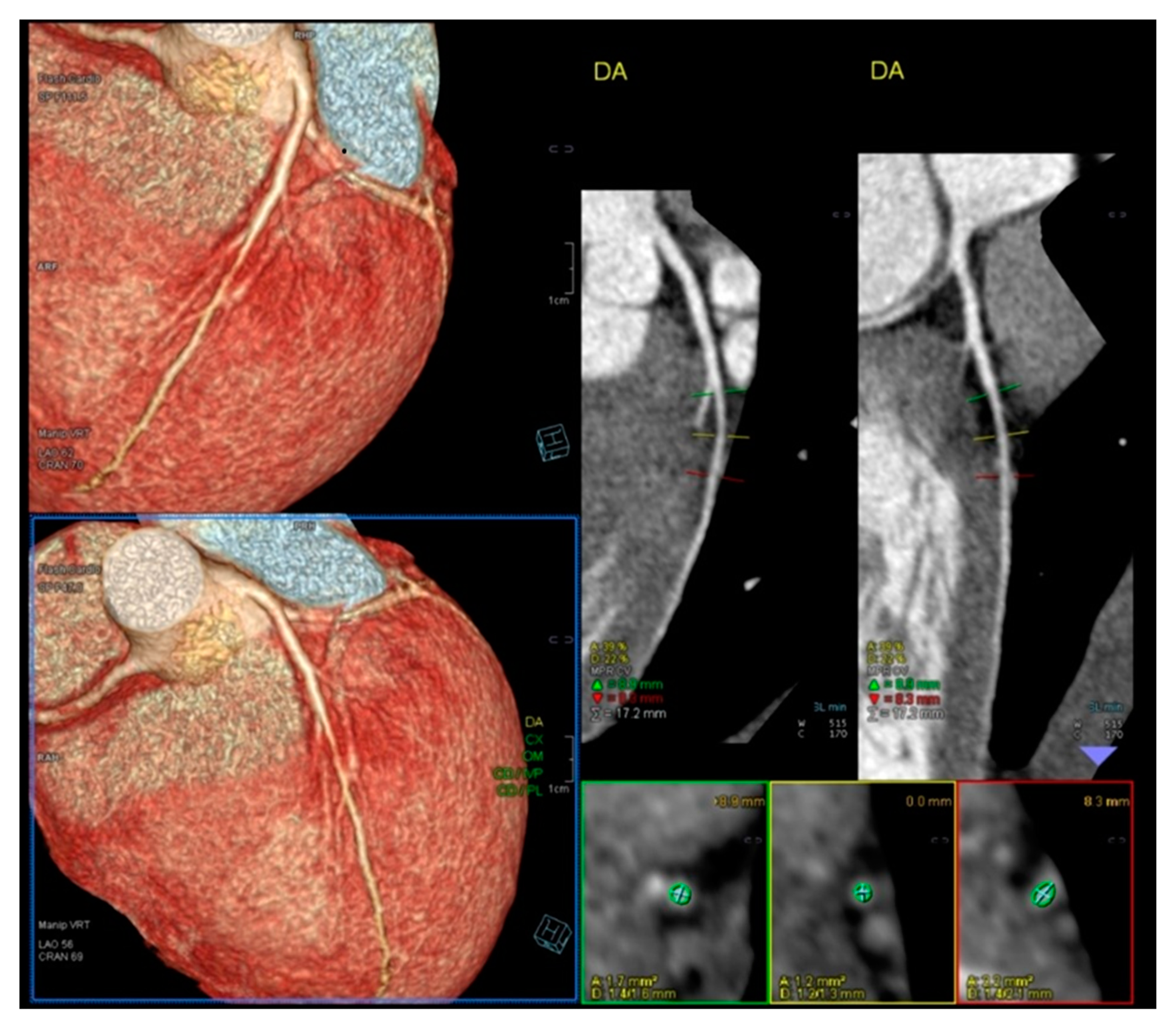 Diagnostics 15 01106 g002