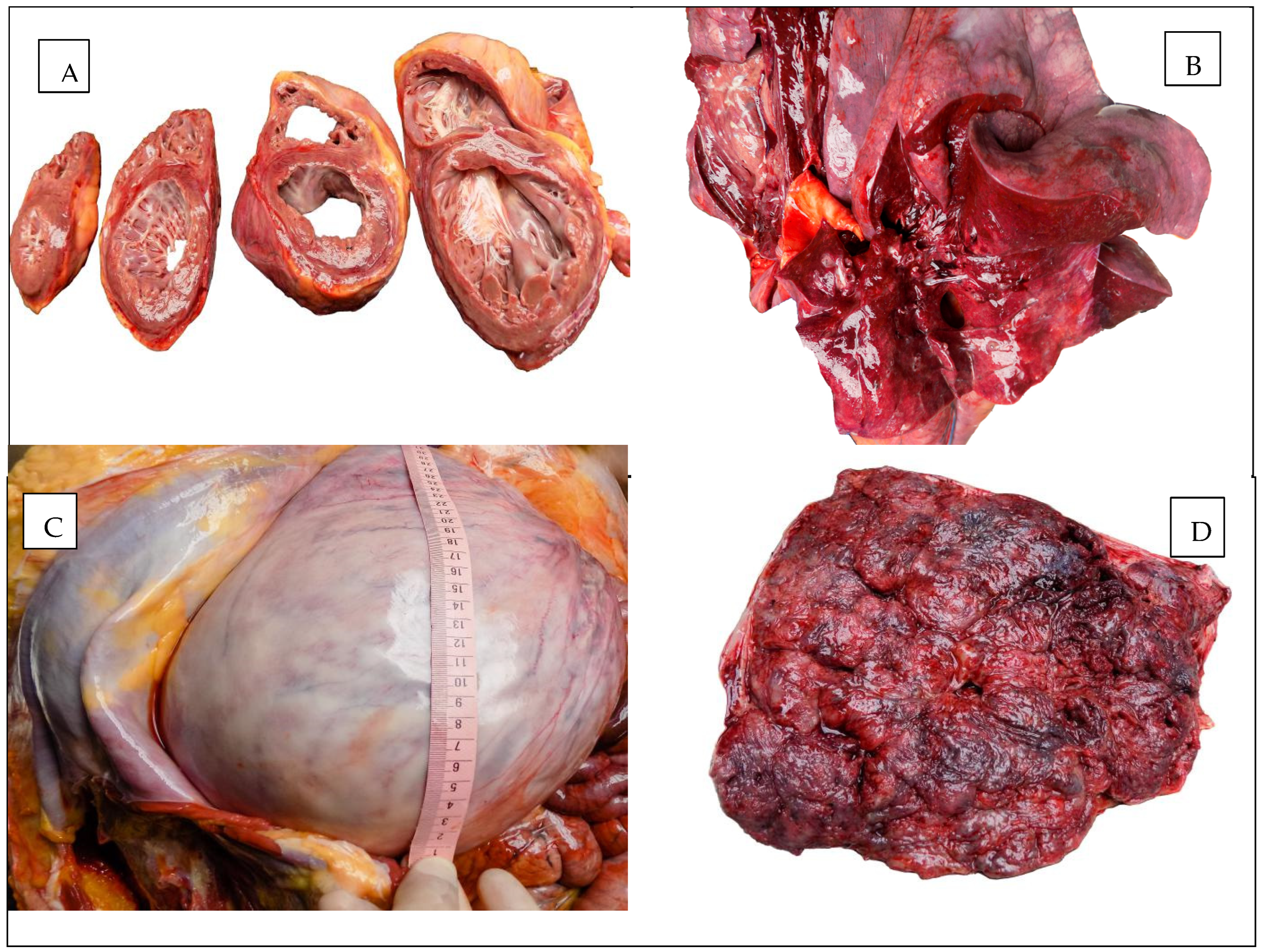 Diagnostics 15 01108 g001