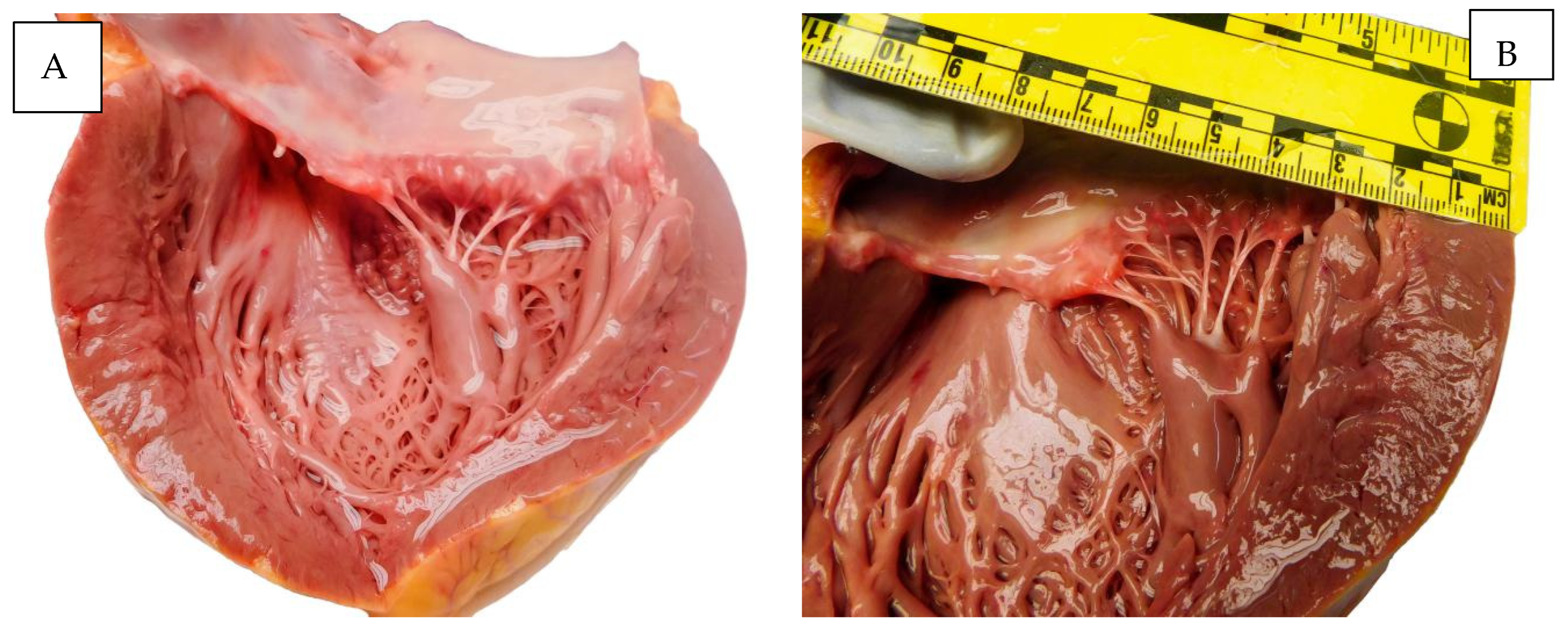 Diagnostics 15 01108 g004a