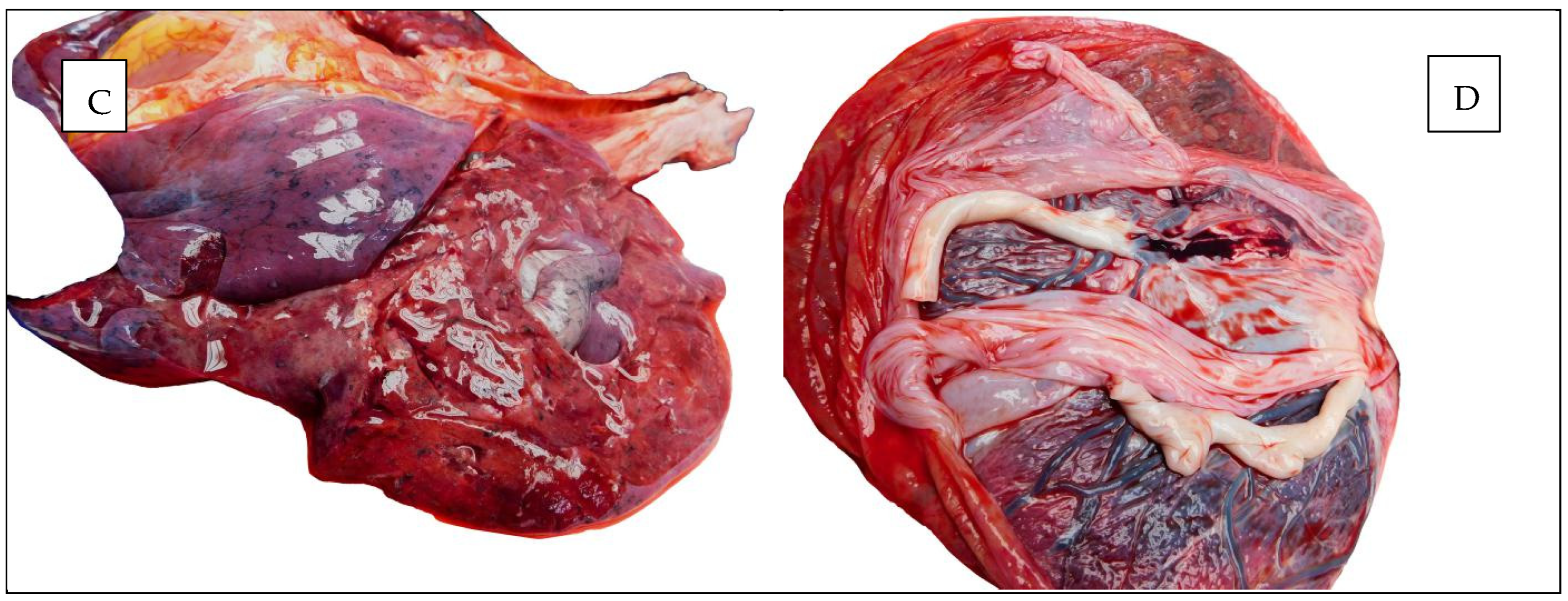 Diagnostics 15 01108 g004b