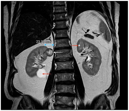 Diagnostics 15 01111 g001