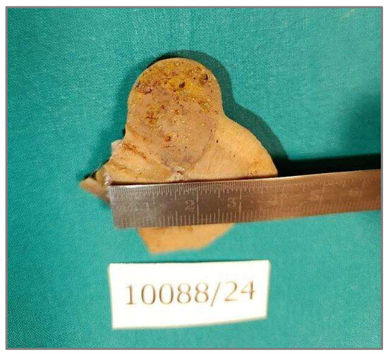 Diagnostics 15 01111 g002