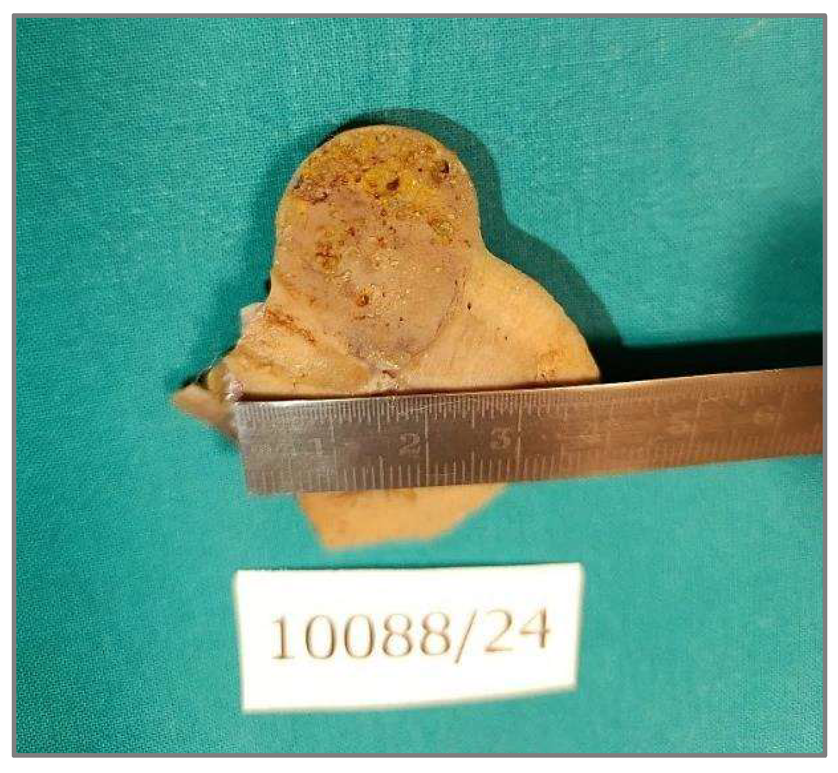 Diagnostics 15 01111 g002