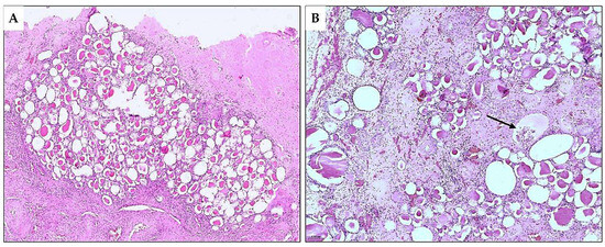 Diagnostics 15 01111 g005