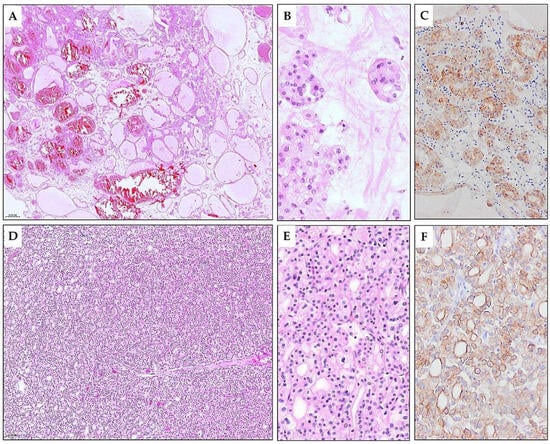 Diagnostics 15 01111 g006