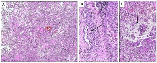Diagnostics 15 01111 g007