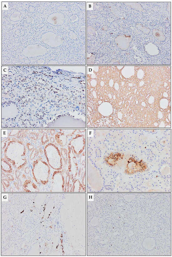 Diagnostics 15 01111 g008