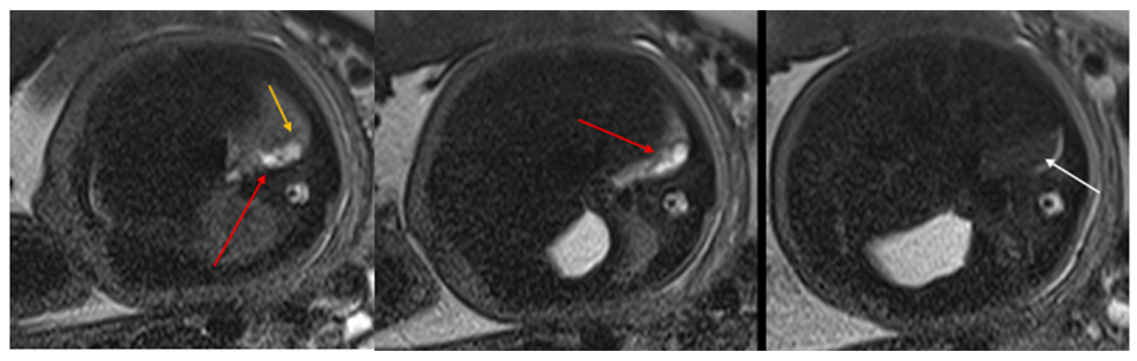 Diagnostics 15 01112 g002