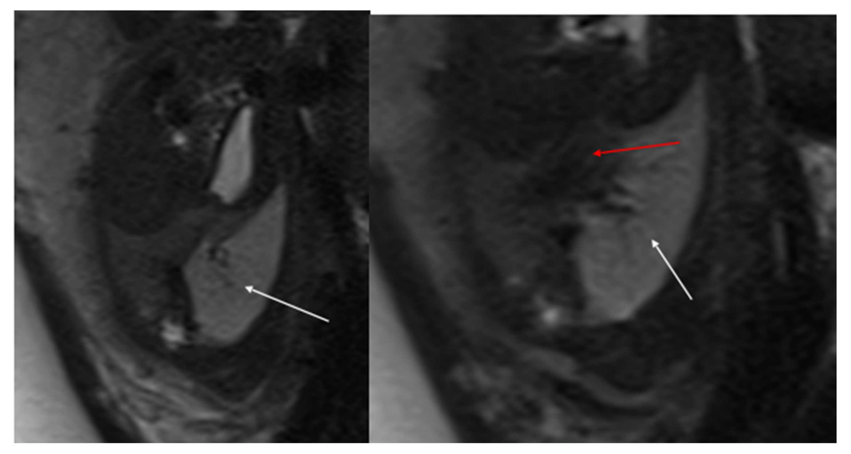Diagnostics 15 01112 g003