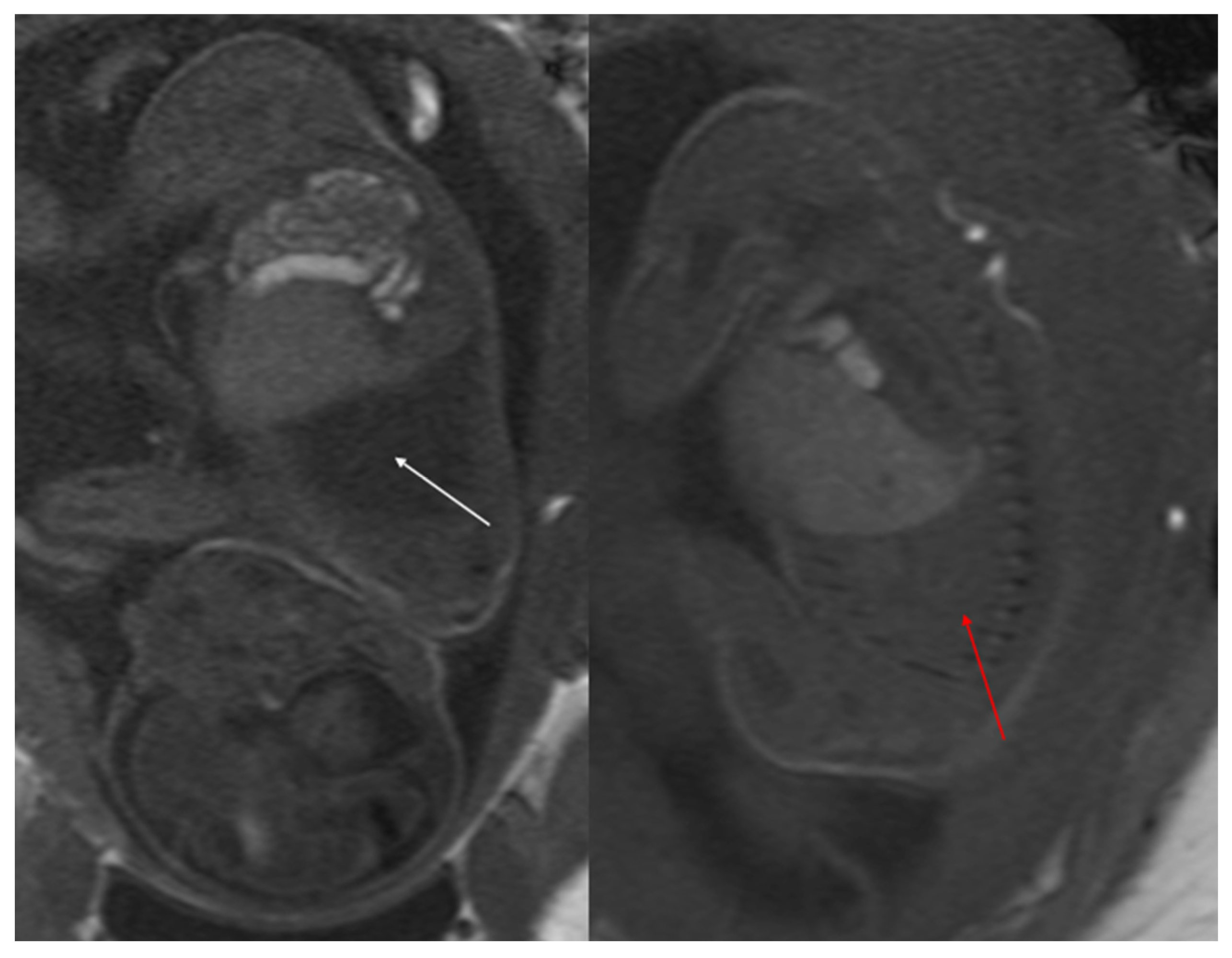 Diagnostics 15 01112 g004
