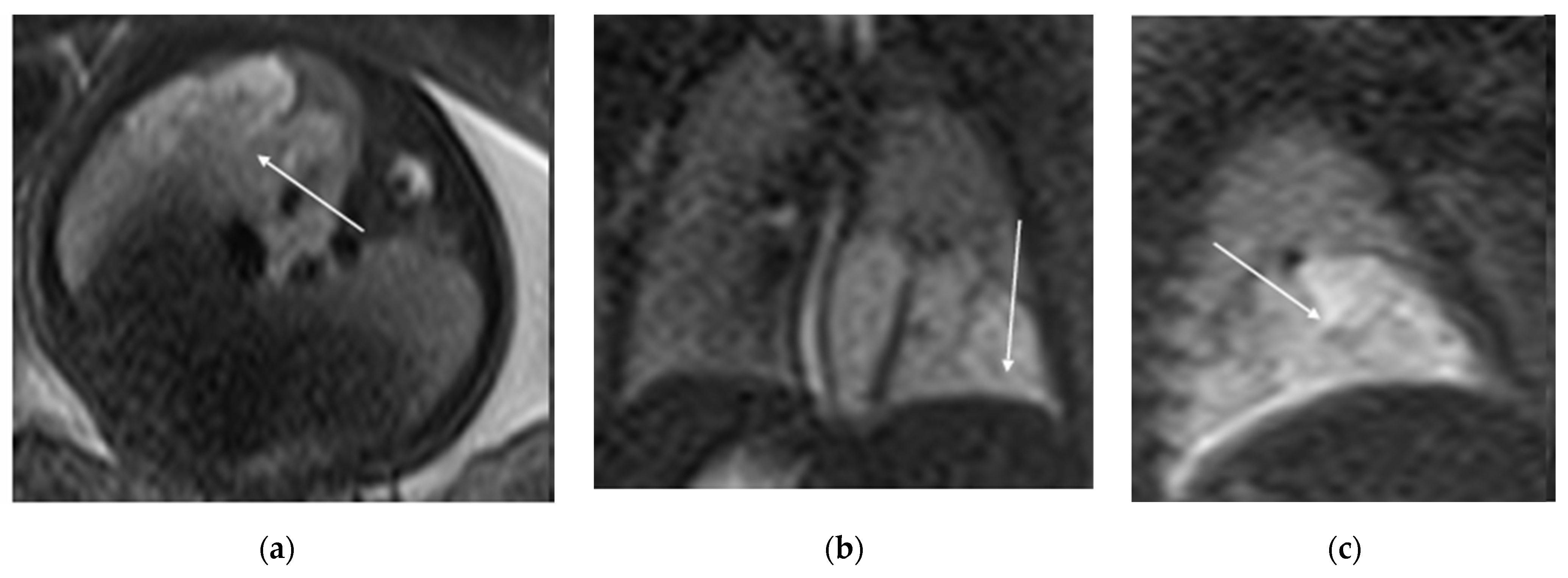 Diagnostics 15 01112 g005