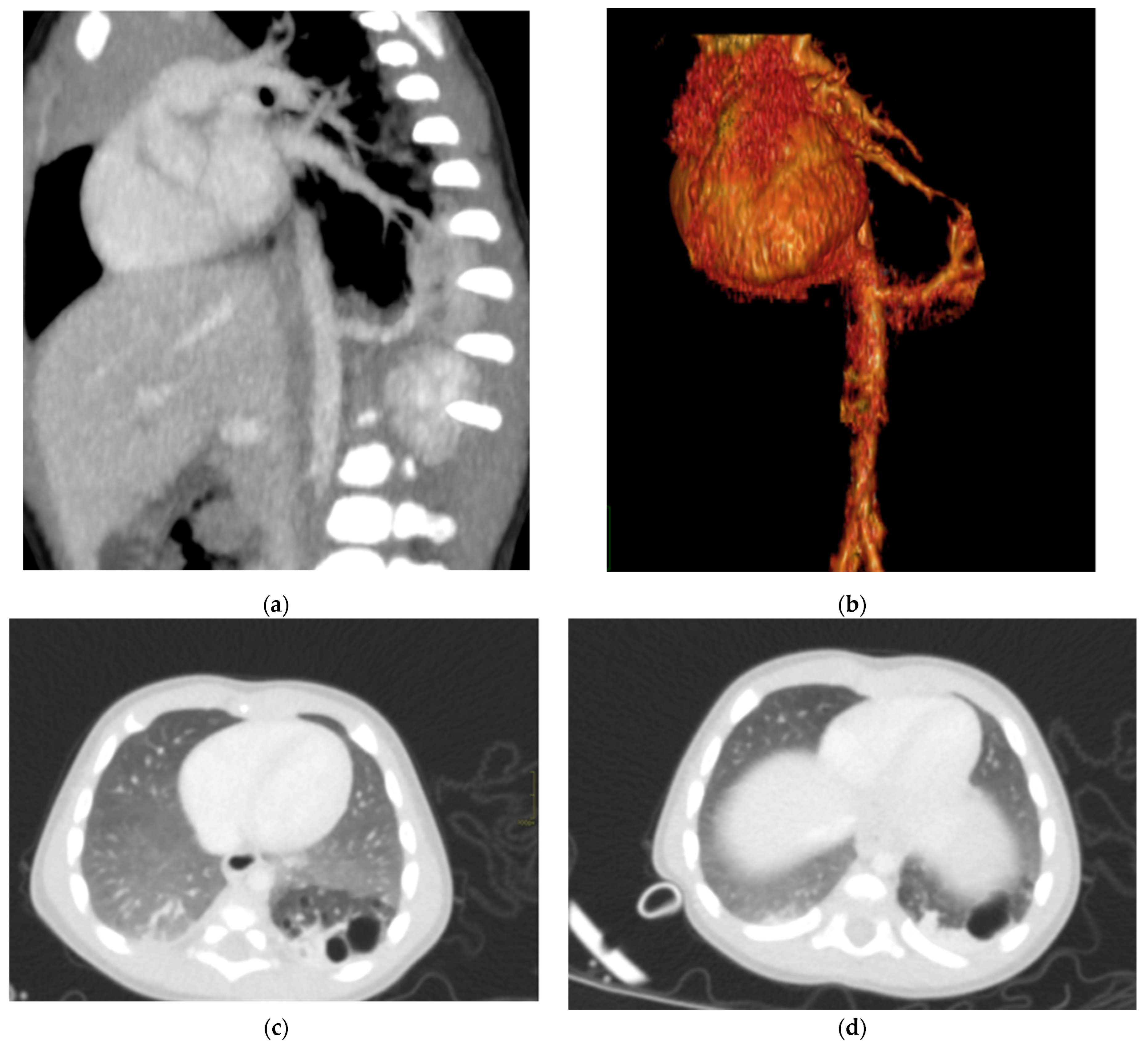 Diagnostics 15 01112 g006