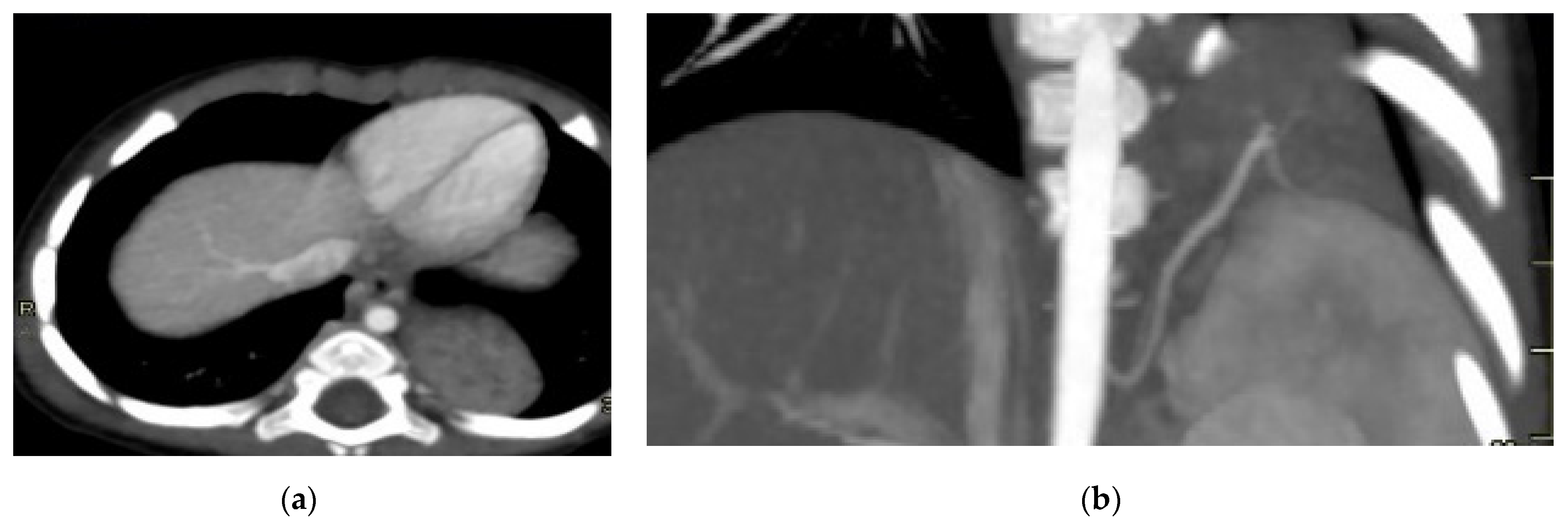 Diagnostics 15 01112 g008a
