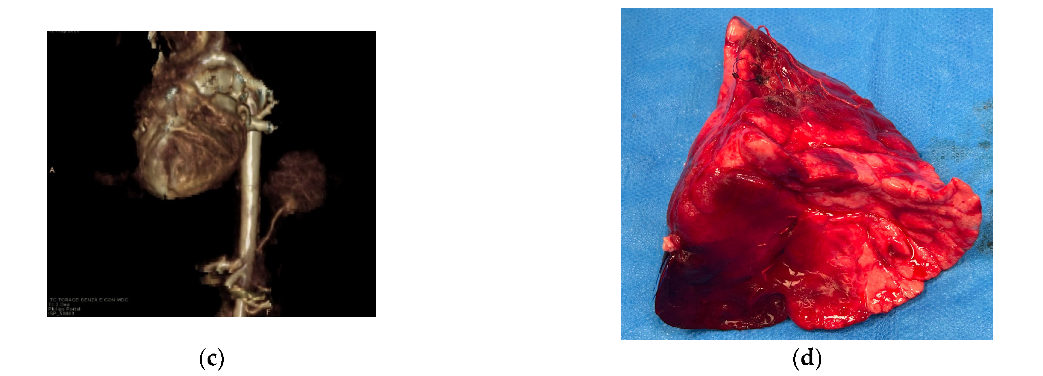 Diagnostics 15 01112 g008b