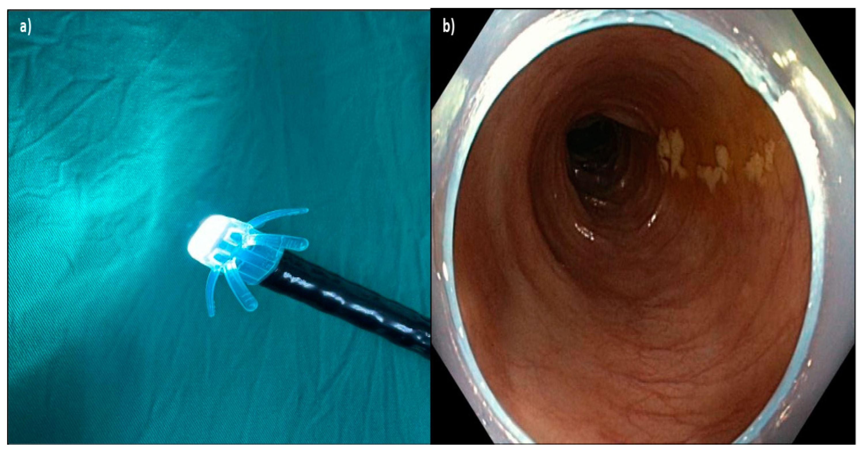 Diagnostics 15 01126 g002