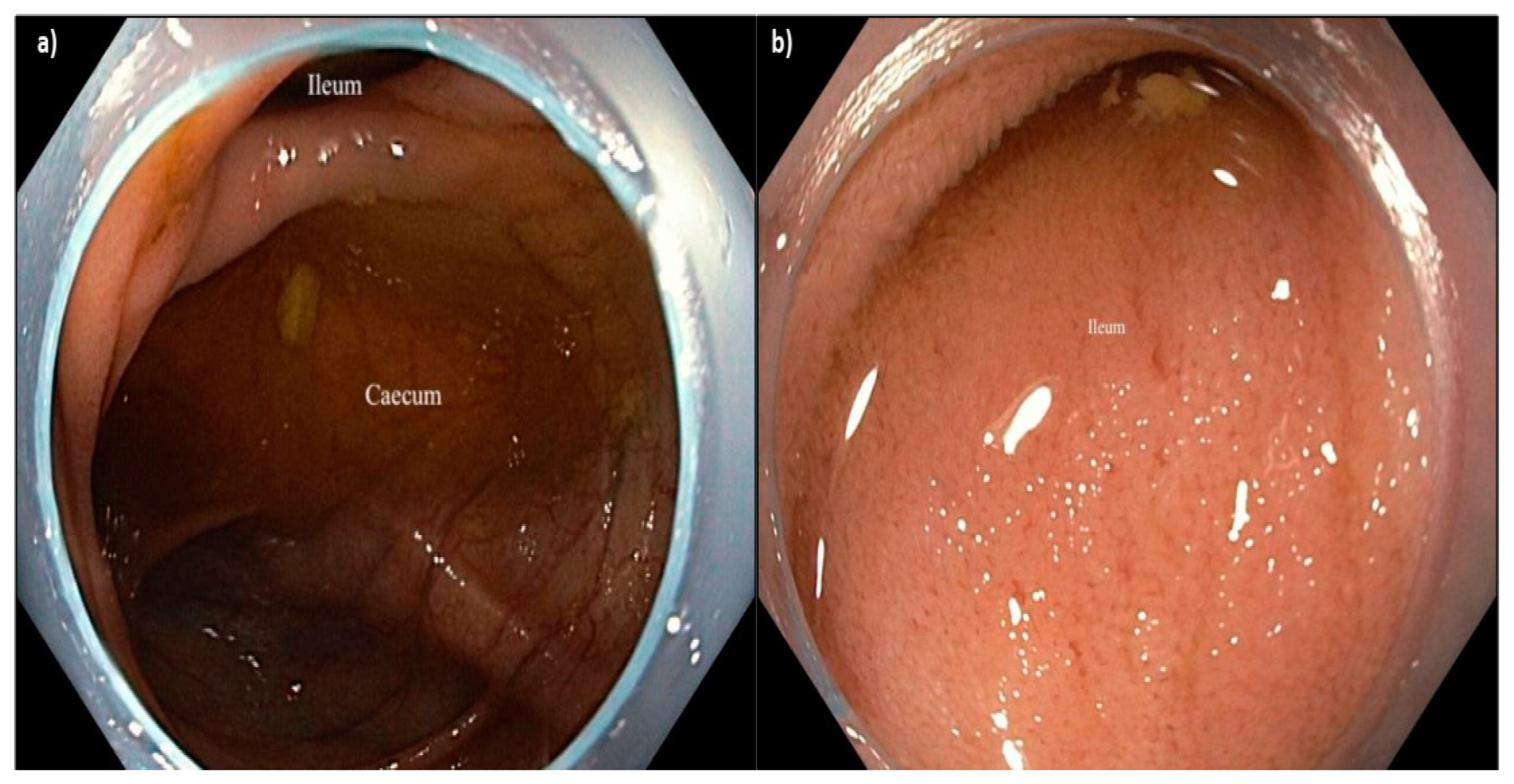 Diagnostics 15 01126 g003