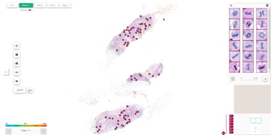 Diagnostics 15 01127 g0a1a