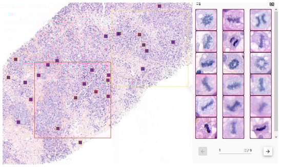 Diagnostics 15 01127 g0a1b