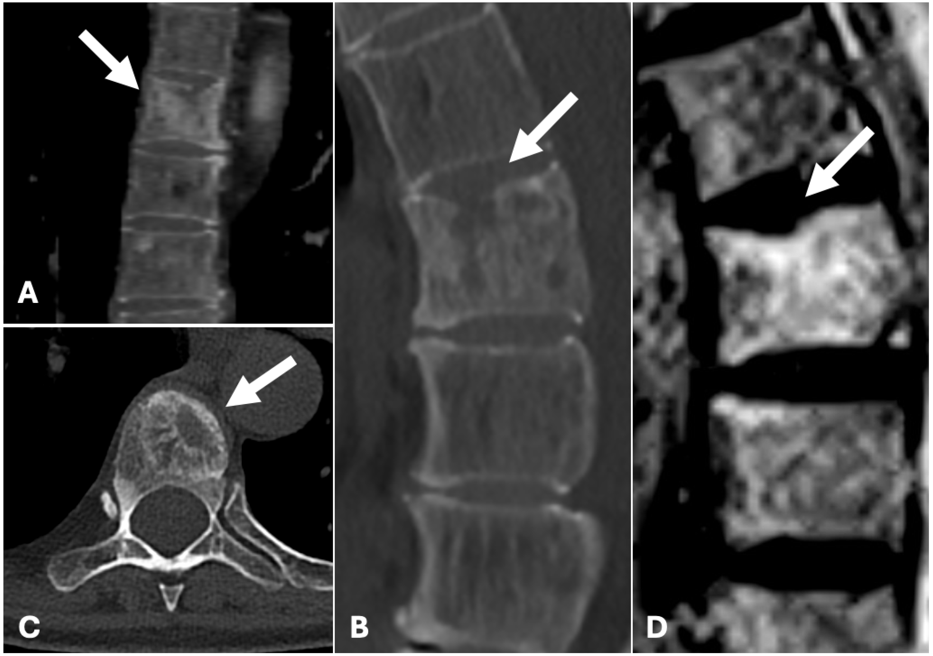 Diagnostics 15 01128 g004
