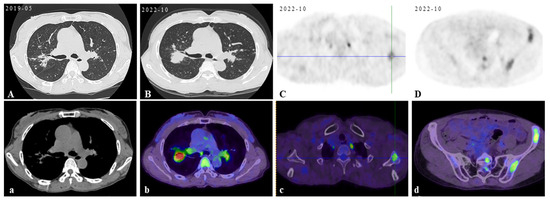 Diagnostics 15 01135 g001